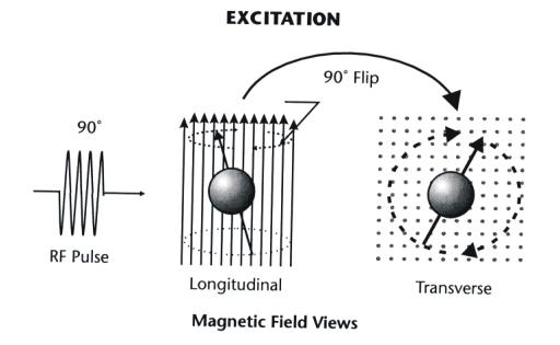 Resonance Imaging